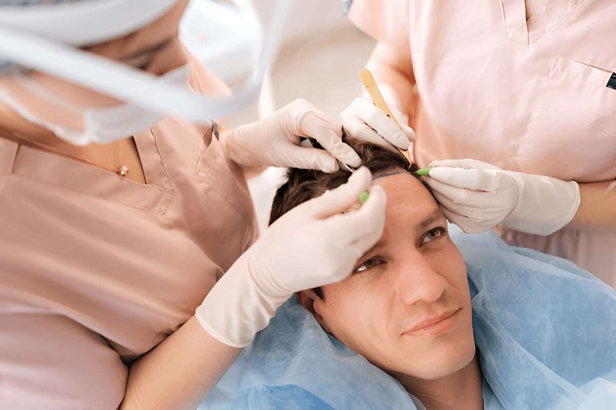hair transplant UK