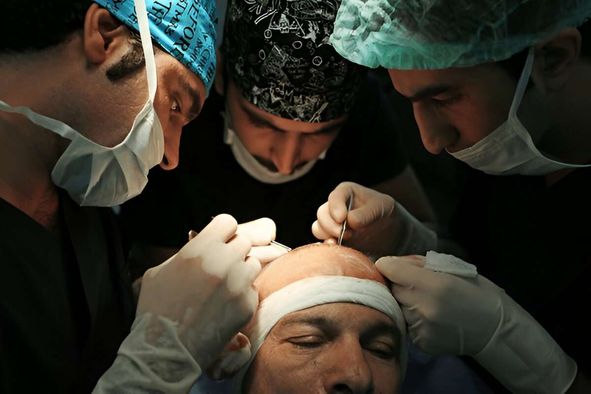 hair transplant