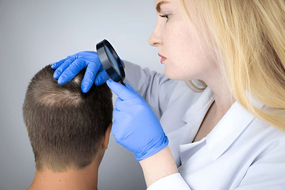 Hair Transplant