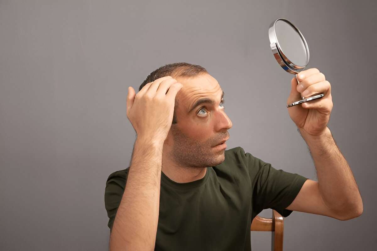 London hair transplant