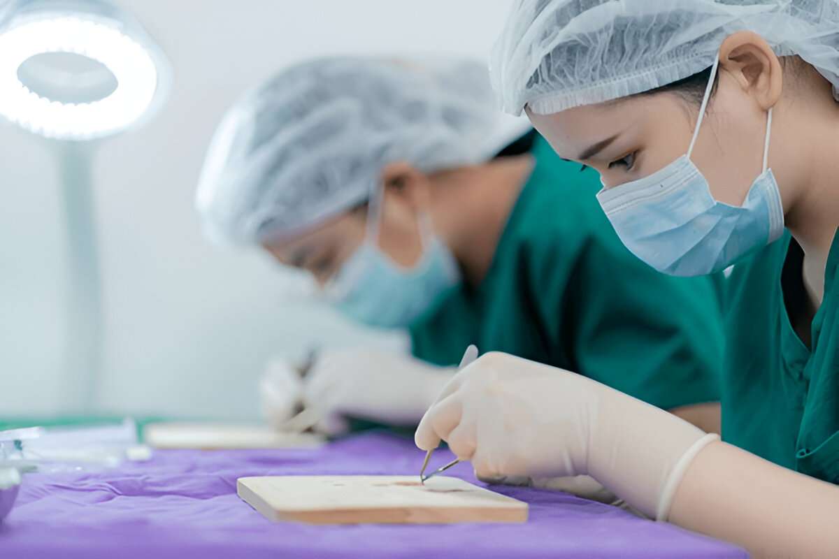 manual hair transplant London