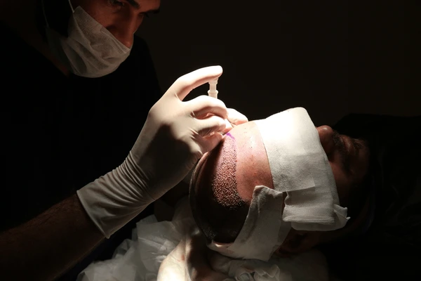 Jude Law hair transplant before and after